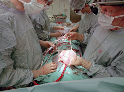 Fetal tissue implant